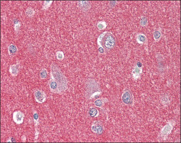 Anti-ARHGEF17 / TEM4 antibody produced in rabbit