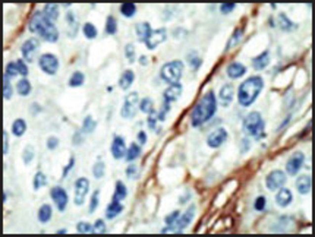 Anti-ARK5 (C-term) antibody produced in rabbit