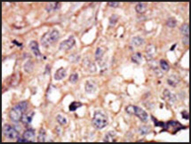 Anti-ARK5 (N-term) antibody produced in rabbit