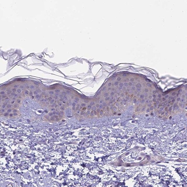 Anti-ARHGEF37 antibody produced in rabbit