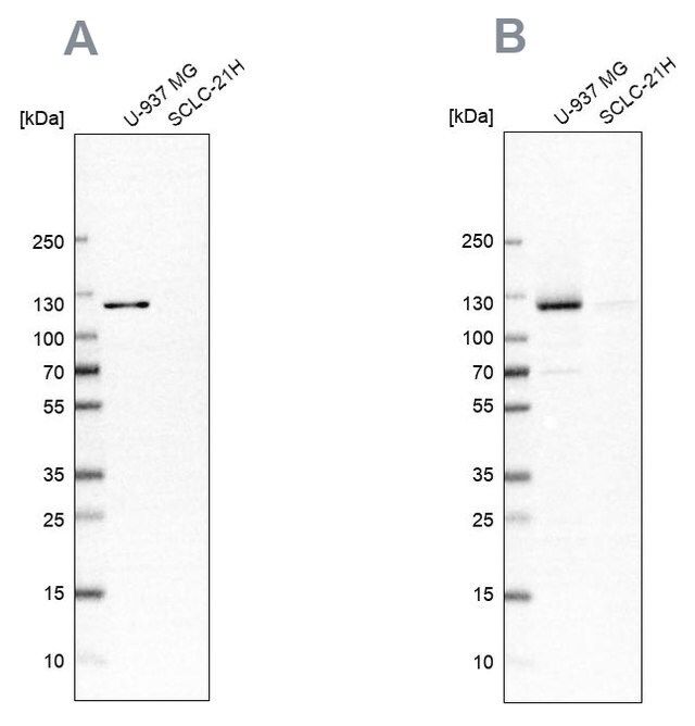 Anti-ARHGEF1 antibody produced in rabbit