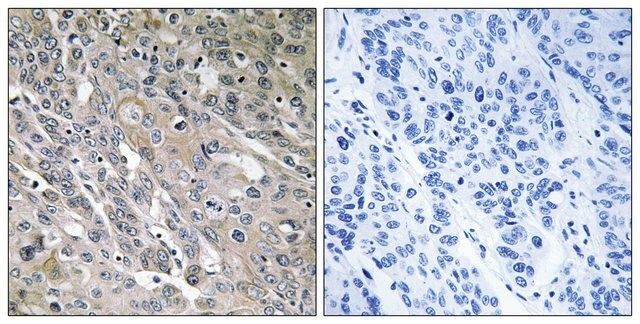 Anti-ARHGEF9 antibody produced in rabbit