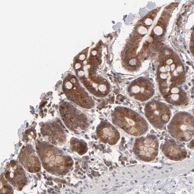 Anti-ARIH1 antibody produced in rabbit