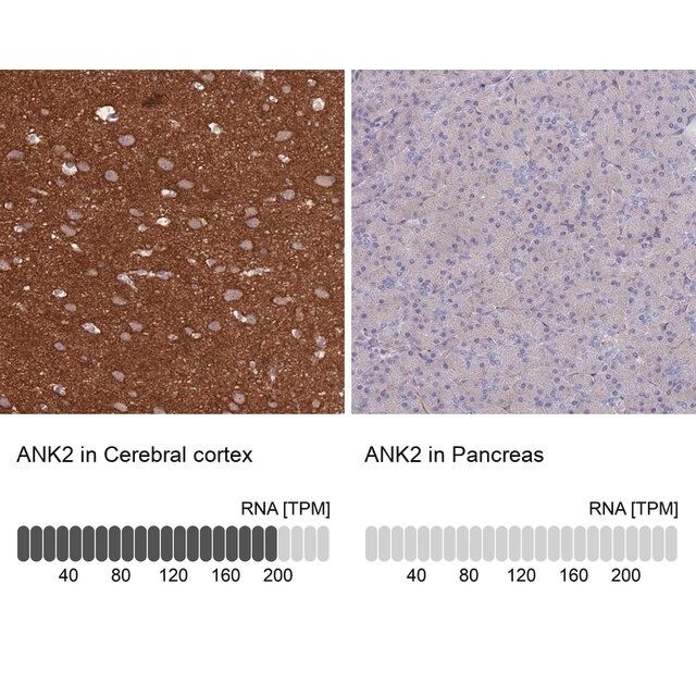 Anti-ANK2 antibody produced in rabbit