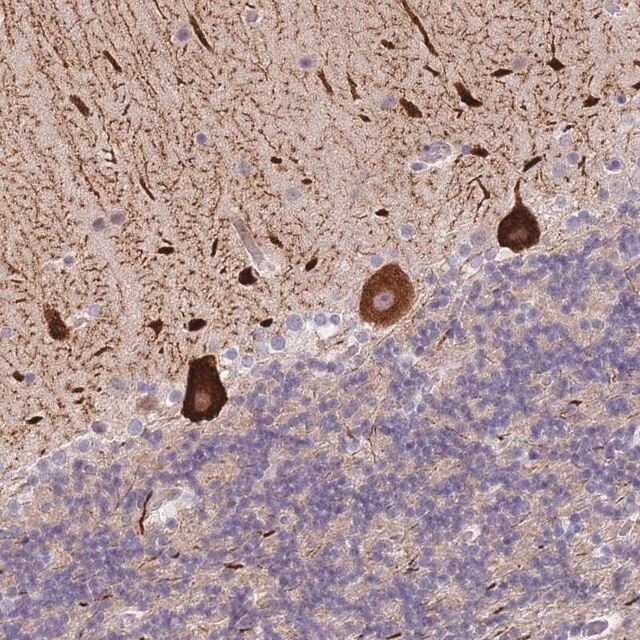 Anti-ANKRD10 antibody produced in rabbit