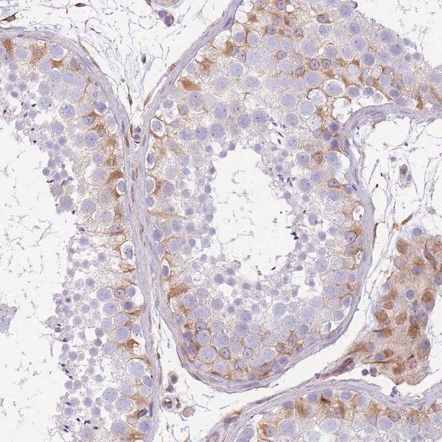 Anti-ANKRD53 antibody produced in rabbit