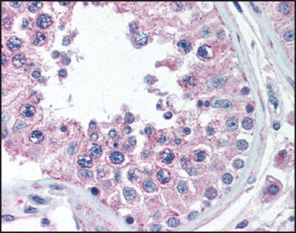 Anti-ANKRD32 antibody produced in rabbit