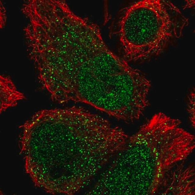 Anti-ANKRD37 antibody produced in rabbit