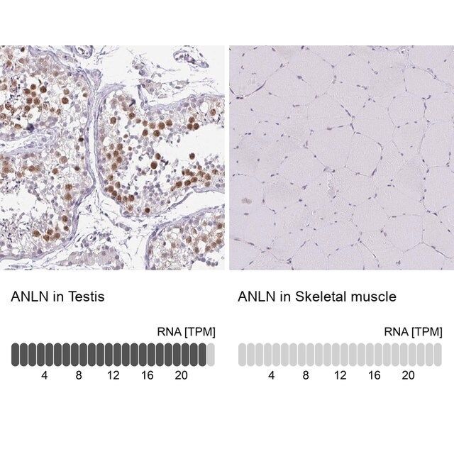 Anti-ANLN antibody produced in rabbit