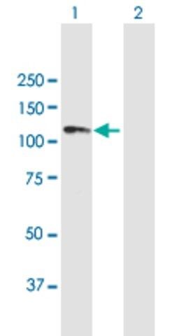 Anti-ANKRD20A1 antibody produced in mouse