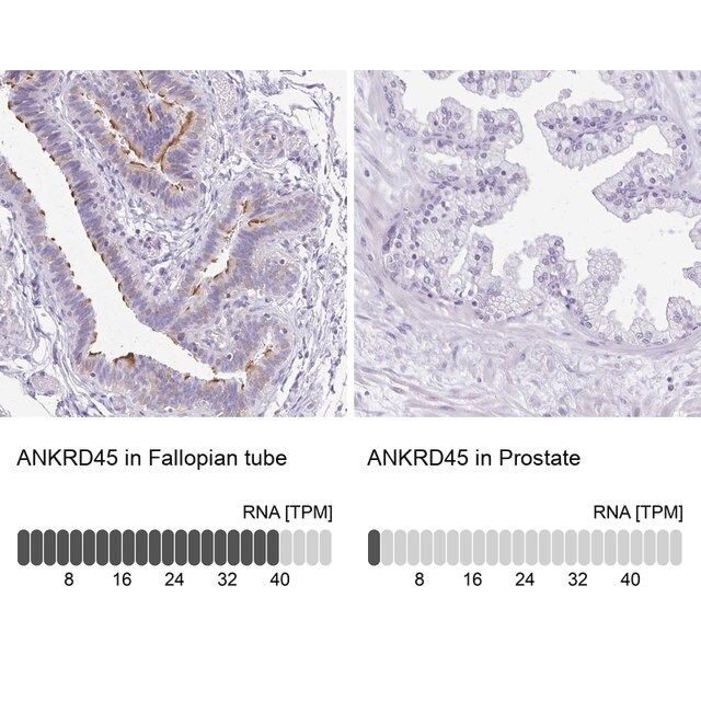 Anti-ANKRD45 antibody produced in rabbit