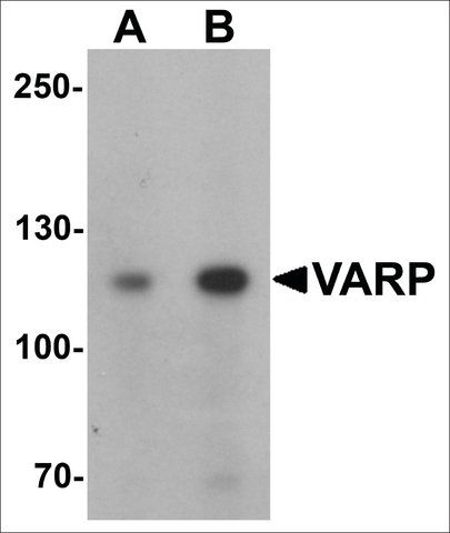 Anti-ANKRD27 antibody produced in rabbit