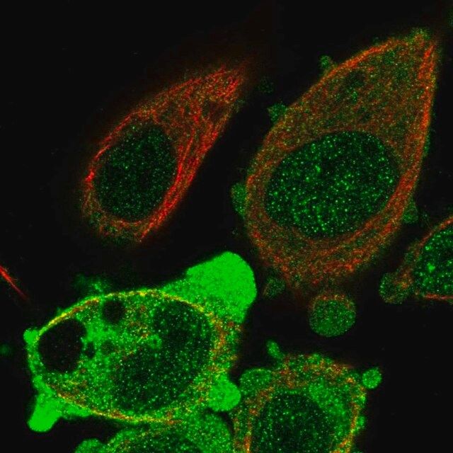 Anti-ANKRD36 antibody produced in rabbit