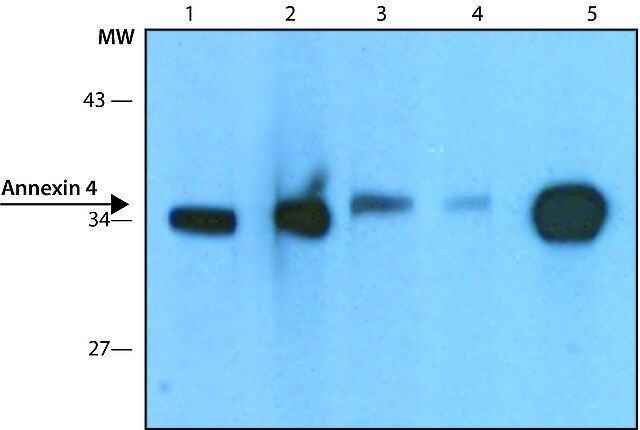 Anti-Annexin 4 antibody,Mouse monoclonal