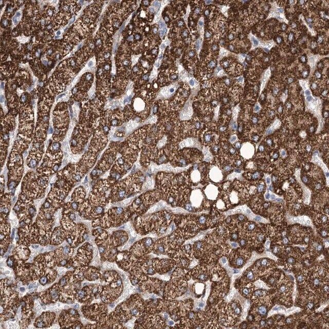 Anti-ANGPTL3 antibody produced in rabbit