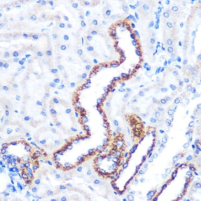 Anti-ANGPT2 antibody produced in rabbit