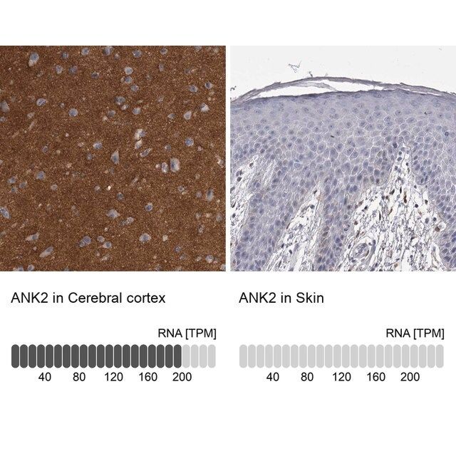 Anti-ANK2 antibody produced in rabbit