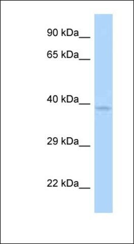 Anti-ANKRD9 antibody produced in rabbit