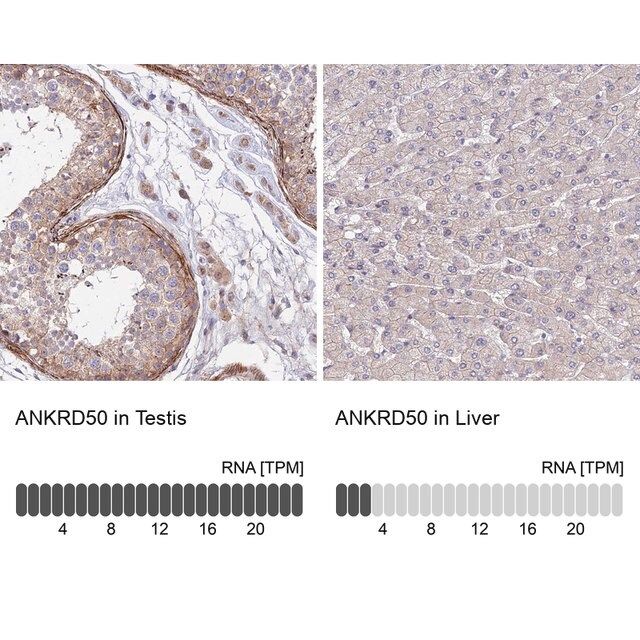 Anti-ANKRD50 antibody produced in rabbit