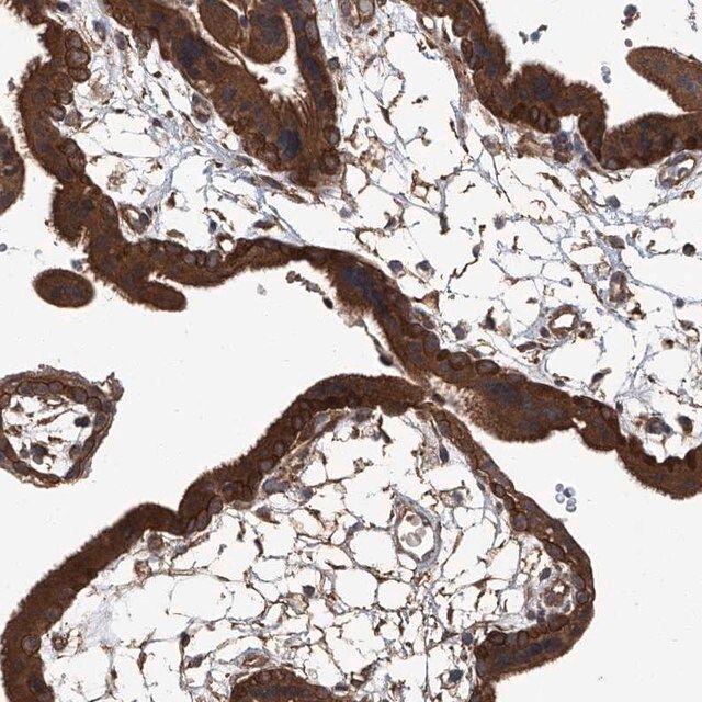 Anti-ANKRD34A antibody produced in rabbit