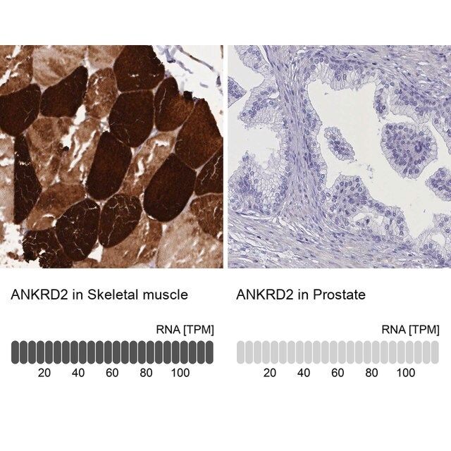 Anti-ANKRD2 antibody produced in rabbit