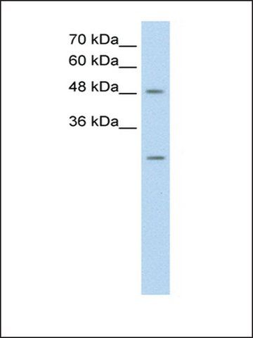 Anti-ANKRD2 antibody produced in rabbit