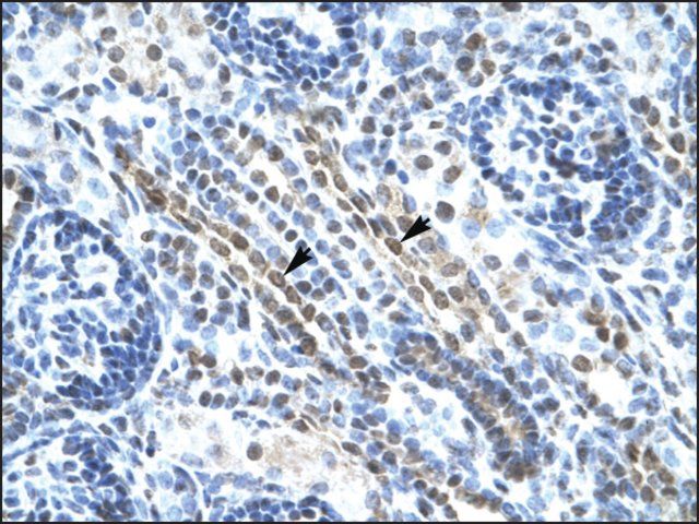 Anti-ANKRD11 antibody produced in rabbit