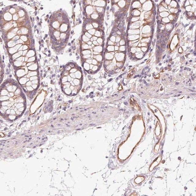 Anti-ANKRD13B antibody produced in rabbit