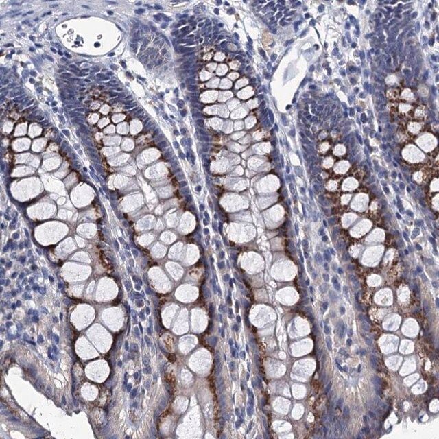 Anti-ANKRD33 antibody produced in rabbit