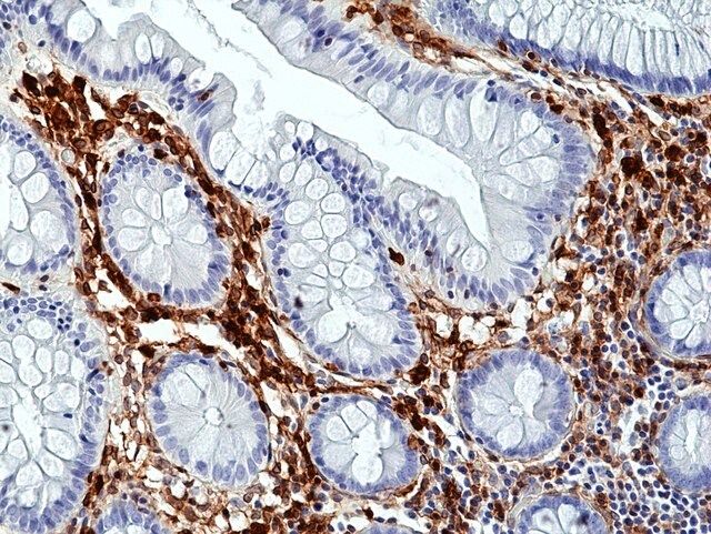 Anti-Annexin A1 Rabbit Monoclonal Antibody