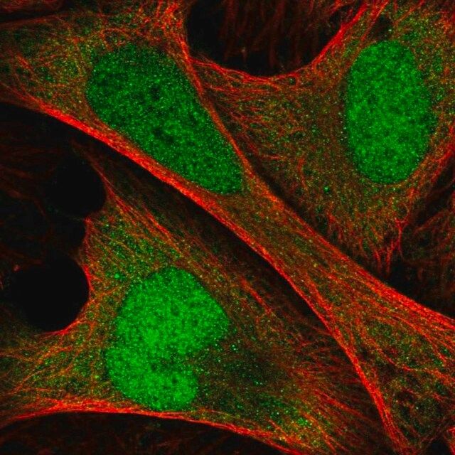 Anti-ANKRD36C antibody produced in rabbit