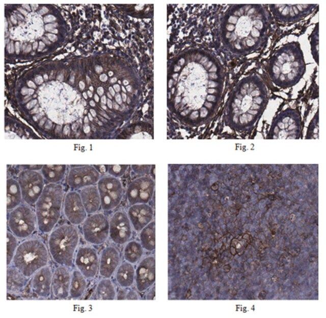 Anti-Annexin A2 Antibody