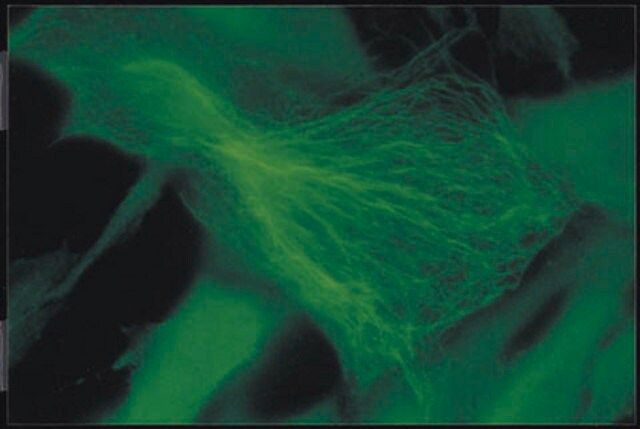 Anti-Ankyrin Antibody, clone Ank016