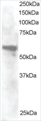 Anti-Annexin A11 antibody produced in goat