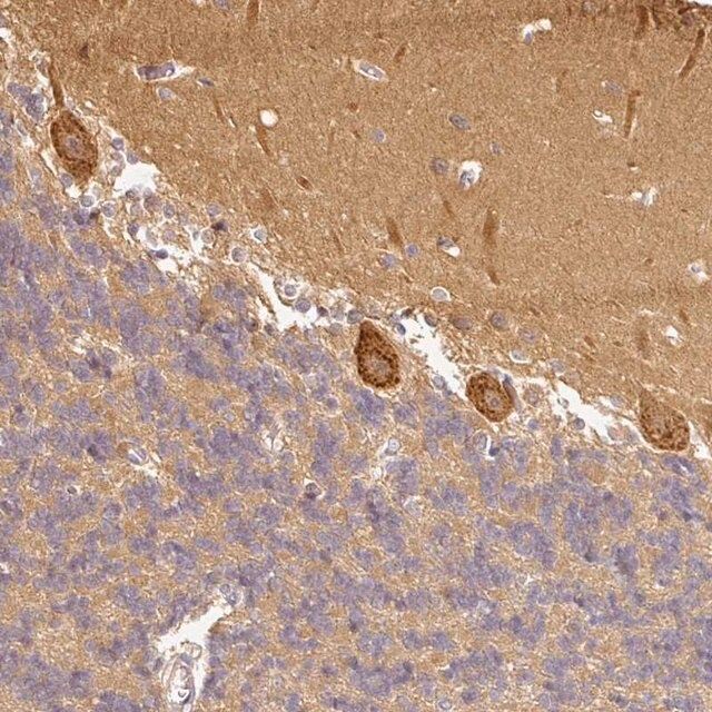 Anti-ANKRD18A antibody produced in rabbit