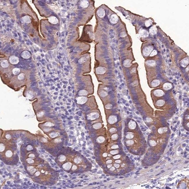 Anti-ANKS4B antibody produced in rabbit