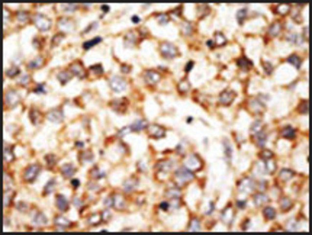 Anti-Apobec1 (N-term) antibody produced in rabbit