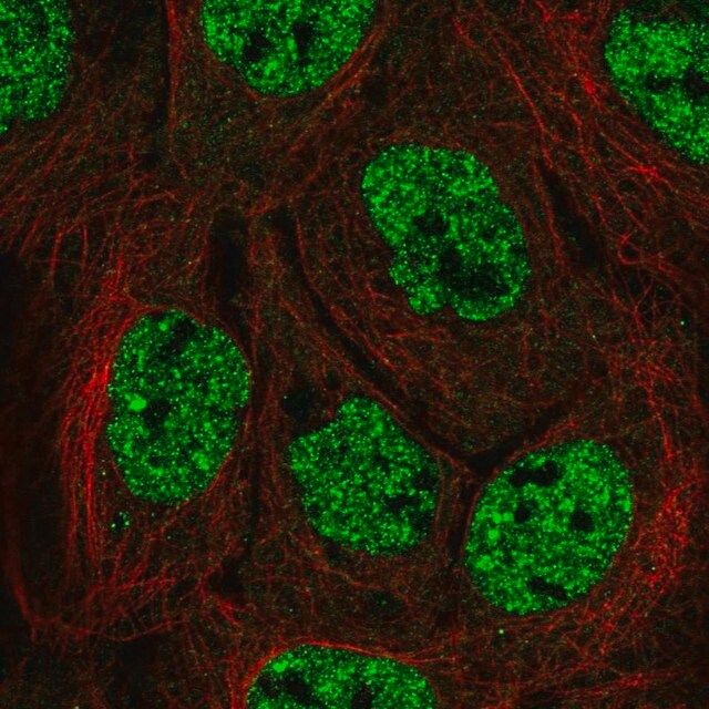 Anti-APOBEC3B antibody produced in rabbit