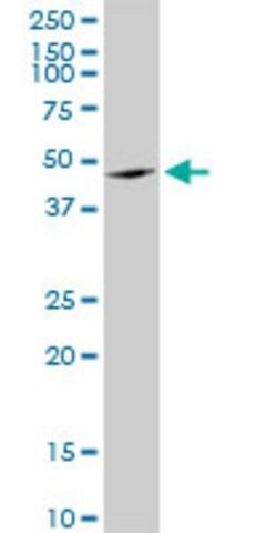 Anti-ANGPTL4 antibody produced in mouse