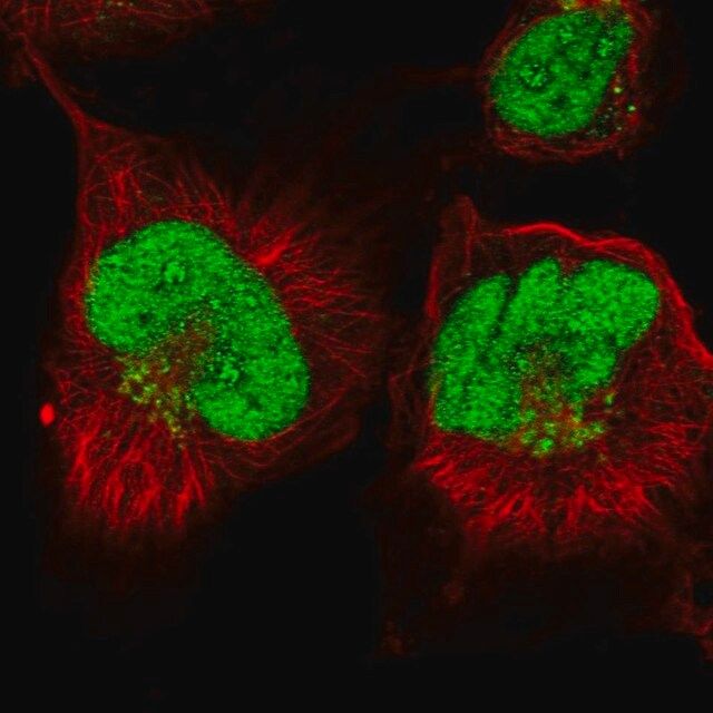 Anti-ANKRD49 antibody produced in rabbit