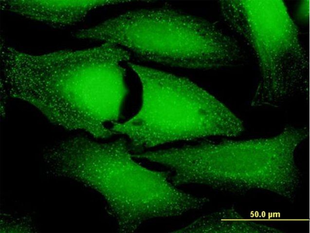 Anti-ANKFY1 antibody produced in mouse