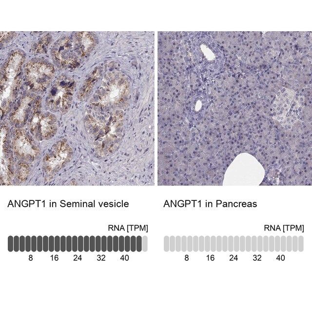 Anti-ANGPT1 antibody produced in rabbit