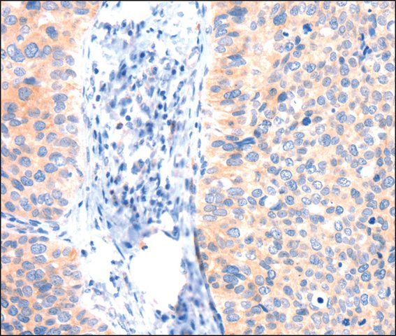 Anti-ANK3 antibody produced in rabbit