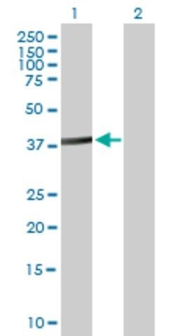 Anti-ACTL8 antibody produced in mouse