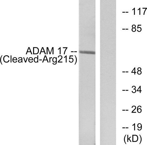 Anti-ADAM 17 (Cleaved-Arg<sup>215</sup>) antibody produced in rabbit