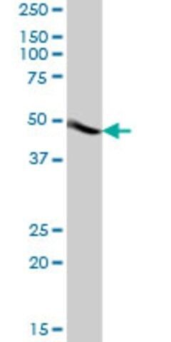 Anti-ACTR3B antibody produced in mouse