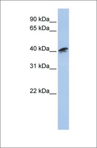 Anti-ACTR1A antibody produced in rabbit