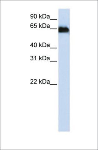 Anti-ADAM12 antibody produced in rabbit