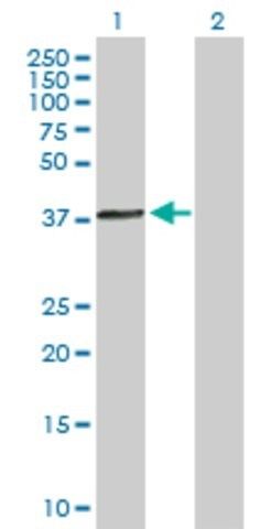 Anti-ACTRT1 antibody produced in mouse