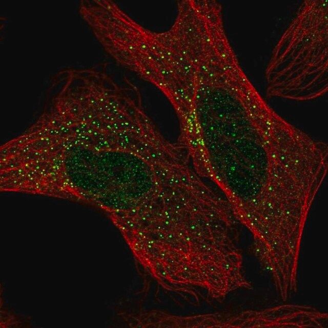 Anti-ADAM32 antibody produced in rabbit